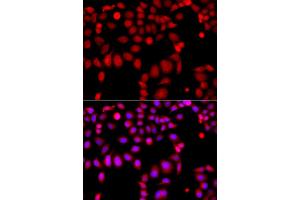 Immunofluorescence analysis of A549 cells using ARHGEF9 antibody (ABIN5975759). (Arhgef9 antibody)