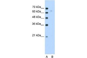 WB Suggested Anti-TOX Antibody Titration:  0. (TOX antibody  (N-Term))