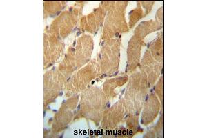 NDUFAF2 Antibody (Center) (ABIN657264 and ABIN2846359) immunohistochemistry analysis in formalin fixed and paraffin embedded human skeletal muscle followed by peroxidase conjugation of the secondary antibody and DAB staining. (NDUFAF2 antibody  (AA 71-99))