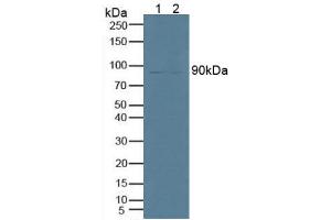 Figure. (PNPLA2 antibody  (AA 484-701))