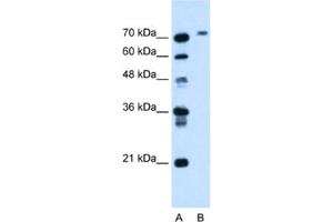 Western Blotting (WB) image for anti-Butyrylcholinesterase (BCHE) antibody (ABIN2462791)
