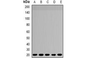 Western blot analysis of NDUFS4 expression in SW620 (A), MCF7 (B), HepG2 (C), mouse brain (D), rat liver (E) whole cell lysates. (NDUFS4 antibody)