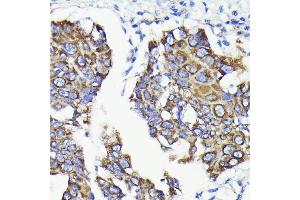 Immunohistochemistry (IHC) image for anti-Fission 1 (FIS1) antibody (ABIN7267209)