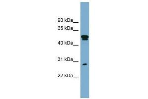 SLA1 antibody used at 1 ug/ml to detect target protein. (SLA antibody  (Middle Region))