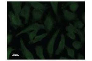 Immunostaining analysis in HeLa cells. (STK3 antibody)