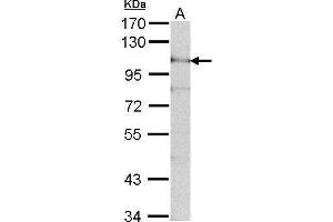 WB Image Sample (30 ug of whole cell lysate) A: NIH-3T3 7. (ADAM15 antibody  (N-Term))