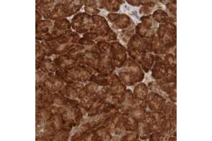 Immunohistochemical staining of human pancreas with MRPL52 polyclonal antibody  shows strong cytoplasmic positivity in exocrine glandular cells at 1:50-1:200 dilution. (MRPL52 antibody)
