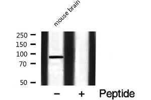 Western blot analysis of FGFR3 expression in Mouse brain lysate (FGFR3 antibody  (C-Term))