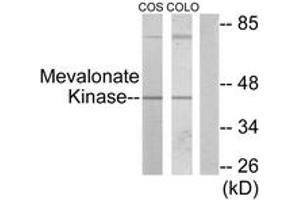 Western blot analysis of extracts from COS7/COLO205 cells, using Mevalonate Kinase Antibody.