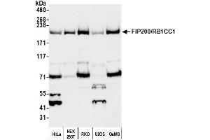 Western Blotting (WB) image for anti-RB1-Inducible Coiled-Coil 1 (RB1CC1) (AA 1544-1594) antibody (ABIN7451783) (FIP200 antibody  (AA 1544-1594))