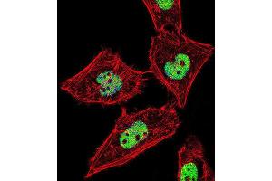 Immunofluorescence (IF) image for anti-RAR-Related Orphan Receptor A (RORA) antibody (ABIN2995882)