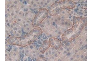 DAB staining on IHC-P; Samples: Rat Kidney Tissue (PITRM1 antibody  (AA 653-926))