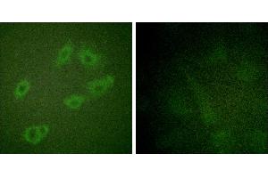 P-peptide - +Immunofluorescence analysis of HuvEc cells, using HER3/ErbB3 (Phospho-Tyr1222) antibody. (ERBB3 antibody  (pTyr1222))