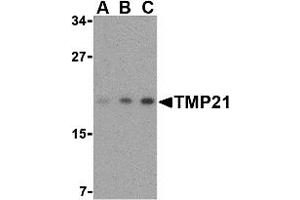 Western Blotting (WB) image for anti-Transmembrane Emp24-Like Trafficking Protein 10 (TMED10) (Middle Region) antibody (ABIN1031137) (TMED10 antibody  (Middle Region))