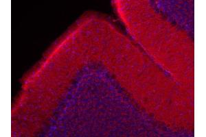 Indirect immunolabeling of mouse cerebellum (PFA fixed and ice-cold methanol for 2 min) (red; dilution 1 : 200).