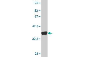 Metabotropic Glutamate Receptor 5 antibody  (AA 419-518)