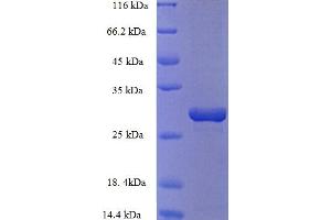 SDS-PAGE (SDS) image for Potassium Voltage-Gated Channel, Shal-Related Subfamily, Member 1 (Kcnd1) (AA 410-647), (Cytoplasmic Domain), (Cytosolic) protein (His tag) (ABIN5709789) (KCND1 Protein (AA 410-647, Cytoplasmic Domain, Cytosolic) (His tag))