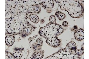 Immunoperoxidase of monoclonal antibody to DGKA on formalin-fixed paraffin-embedded human placenta. (DGKA antibody  (AA 1-735))