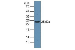 Detection of HMGB1 in Human Jurkat Cells using Monoclonal Antibody to High Mobility Group Protein 1 (HMGB1) (HMGB1 antibody  (AA 1-215))