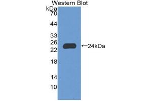 Detection of Recombinant NCF2, Human using Polyclonal Antibody to Neutrophil Cytosolic Factor 2 (NCF2) (NCF2 antibody  (AA 355-526))