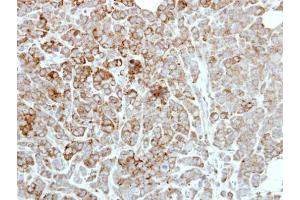 IHC-P Image Immunohistochemical analysis of paraffin-embedded MDAMB468 xenograft, using PDE1A, antibody at 1:500 dilution. (PDE1A antibody)
