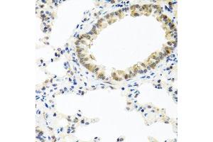 Immunohistochemistry (Paraffin-embedded Sections) (IHC (p)) image for anti-Bone Morphogenetic Protein 5 (BMP5) (AA 317-454) antibody (ABIN6137604)