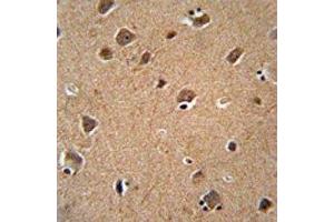 Immunohistochemistry (IHC) image for anti-V-Akt Murine Thymoma Viral Oncogene Homolog 3 (Protein Kinase B, Gamma) (AKT3) antibody (ABIN3029481)