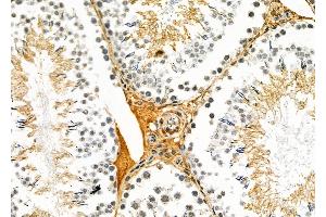 ABIN6260068 and ABIN6279106 at 1/100 staining Rat testis tissue by IHC-P.
