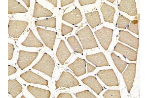 ABIN7097156 and ABIN7101224 at 1/100 staining rat muscle tissue by IHC-P. (CPQ antibody)