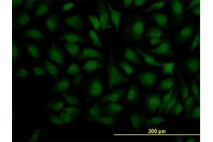Image no. 3 for anti-Decapping Enzyme, Scavenger (DCPS) (AA 1-338) antibody (ABIN599227) (DCPS antibody  (AA 1-338))