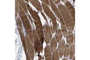 Immunohistochemical staining of human skeletal muscle shows strong cytoplasmic positivity in myocytes. (PRMT2 antibody)