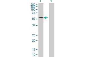 Western Blot analysis of KRT4 expression in transfected 293T cell line by KRT4 MaxPab polyclonal antibody. (KRT4 antibody  (AA 1-534))