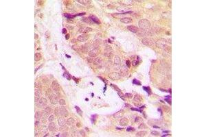 Immunohistochemistry (IHC) image for anti-TNF Receptor-Associated Factor 2 (TRAF2) antibody (ABIN7308436) (TRAF2 antibody)