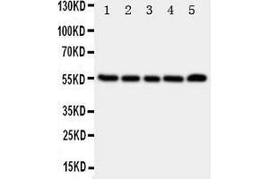 Western Blotting (WB) image for anti-Tachykinin Receptor 1 (TACR1) (AA 231-245), (Middle Region) antibody (ABIN3044262) (TACR1 antibody  (Middle Region))