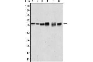 Western blot analysis using AKT2 mouse mAb against A431 (1), Jurkat (2), HEK293 (3), A549 (4), MCF-7 (5) and PC-12 (6) cell lysate.