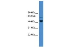 Image no. 1 for anti-Zinc Finger Protein 265 (Zranb2) (AA 101-150) antibody (ABIN6745453) (ZNF265 antibody  (AA 101-150))