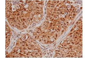 Immunohistochemistry (IHC) image for anti-Microtubule-Associated Protein tau (MAPT) (pSer262) antibody (ABIN6256228)