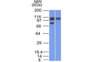 Western Blot of A431 and MCF-7 cell lysate using Catenin, alpha-1 Mouse Monoclonal Antibody (1G5).