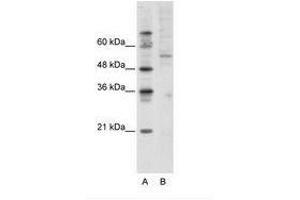 Image no. 1 for anti-Activating Transcription Factor 7 (AFT7) (C-Term) antibody (ABIN202638) (AFT7 antibody  (C-Term))