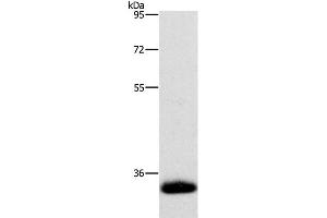 Western Blot analysis of Human testis tissue using AMBP Polyclonal Antibody at dilution of 1:500 (AMBP antibody)