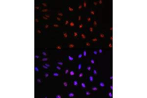 Immunofluorescence analysis of U-2 OS cells using TCF4 Rabbit pAb (ABIN3021529, ABIN3021530, ABIN3021531, ABIN1513591 and ABIN6215200) at dilution of 100 (40x lens). (TCF4 antibody  (AA 400-500))