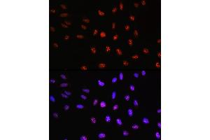 Immunofluorescence analysis of U-2 OS cells using TCF4 Rabbit pAb (ABIN3021529, ABIN3021530, ABIN3021531, ABIN1513591 and ABIN6215200) at dilution of 100 (40x lens).