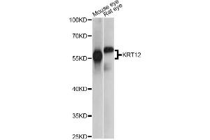 Western blot analysis of extracts of various cell lines, using KRT12 antibody. (KRT12 antibody)