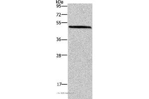 Western blot analysis of Mouse brain tissue, using HOMER1 Polyclonal Antibody at dilution of 1:400 (HOMER1 antibody)