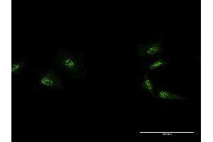 Immunofluorescence (IF) image for anti-Mediator Complex Subunit 4 (MED4) (AA 1-270) antibody (ABIN526061)