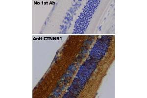 Immunohistochemistry (IHC) image for anti-Catenin, beta (CATNB) (C-Term) antibody (ABIN6254224) (beta Catenin antibody  (C-Term))