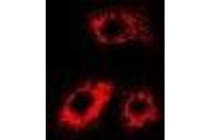 Immunofluorescent analysis of Citrate Synthase staining in MCF7 cells. (CS antibody)