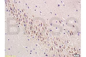 Formalin-fixed and paraffin embedded rat brain labeled with Anti-SEMA7A/CD108 Polyclonal Antibody, Unconjugated (ABIN749363) at 1:200 followed by conjugation to the secondary antibody and DAB staining