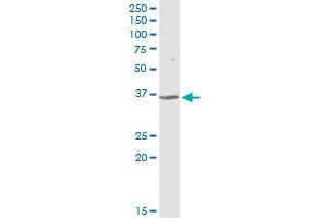 CFHR1 MaxPab rabbit polyclonal antibody. (CFHR1 antibody  (AA 1-330))
