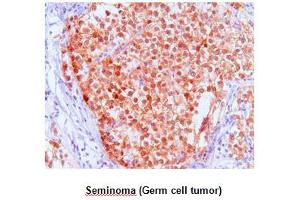 Paraffin embedded sections of Seminoma (Germ cell tumor) tissue were incubated with anti-human FKBP4 (1:50) for 2 hours at room temperature. (FKBP4 antibody  (AA 1-459))